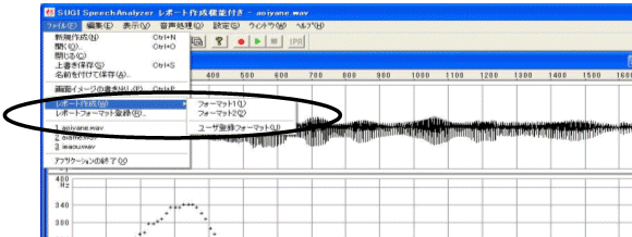 レポート作成機能